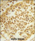 RPL31 Antibody (Center)